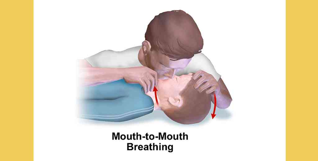 What Is Another Term For Artificial Respiration